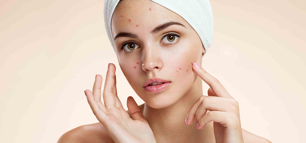 Leczenie trądziku Kraków
